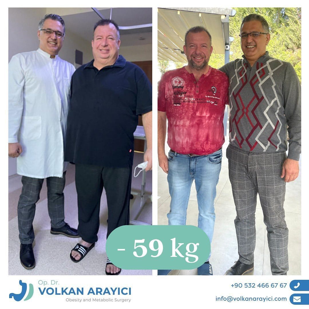 Expertenmeinung: wie viel kostet eine magenverkleinerung bei einem Top-Chirurgen in Izmir?